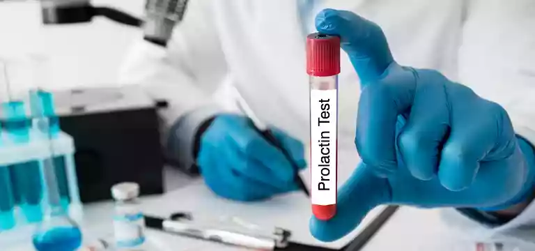 Prolactin Test : A Complete Guide for Test Procedure, Uses and Cost